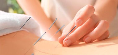 Go to Acupuncture